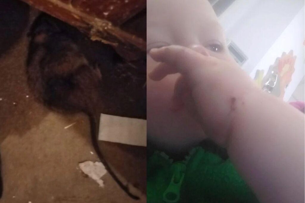 O menino levou 3 mordidas na mão