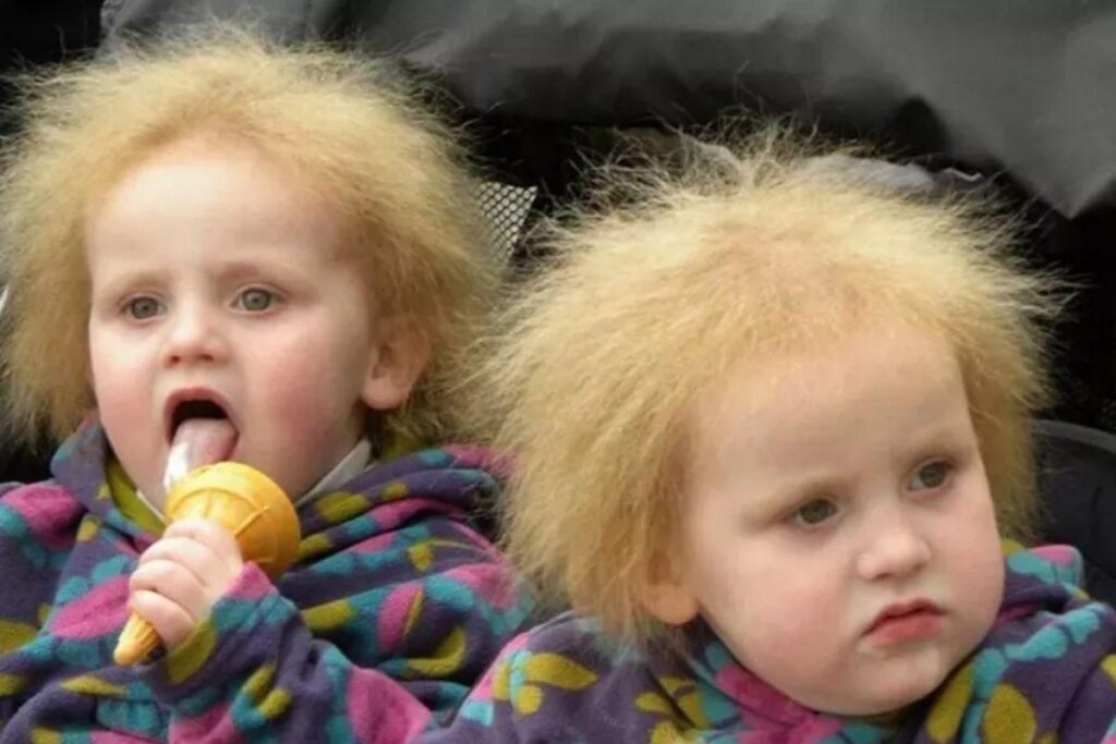 Atualmente elas têm 9 anos