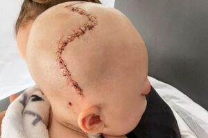 A família comemora a recuperação do bebê