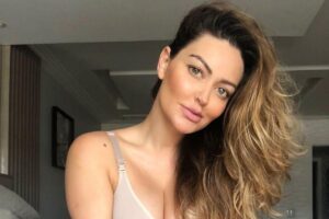 Laura Keller fala sobre acidente que deixou o olho roxo