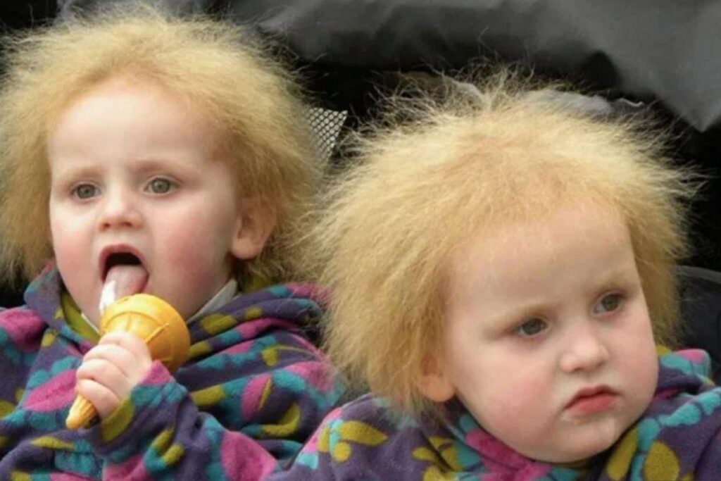 Atualmente elas têm 9 anos