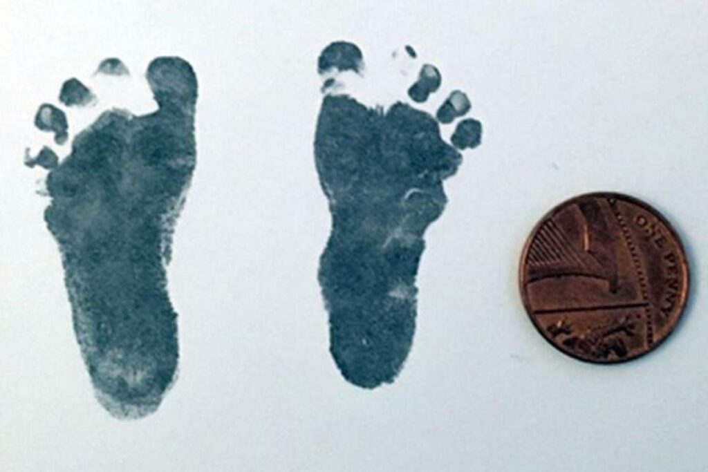 A mãe da bebê prematura de 24 semanas conta sobre a recuperação milagrosa da filha