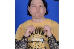 Ele teve o primeiro transplante de rosto e mãos bem-sucedido do mundo