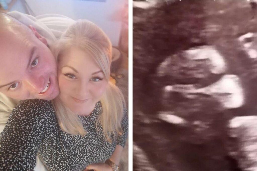 Mãe se diverte ao ver ultrassom do filho