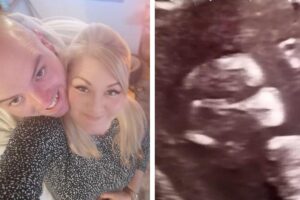 Mãe se diverte ao ver ultrassom do filho