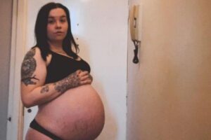 Mulher engravida de trigêmeos mesmo tomando pílula todos os dias