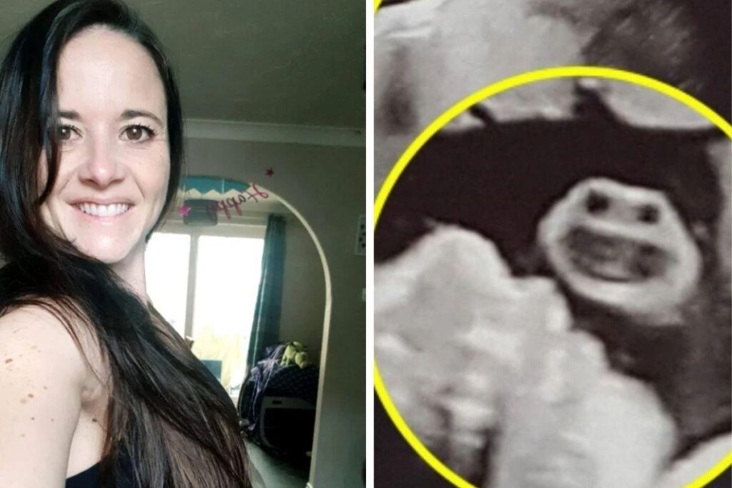 Figura ‘estranha’ em ultrassom espanta mãe