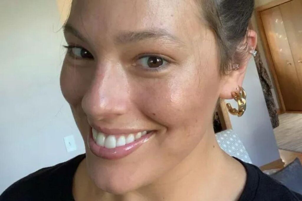 Ashley Graham sofreu com a queda de cabelo no pós-parto