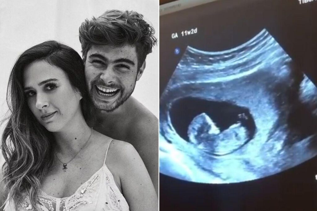 Tatá Werneck dá susto nos fãs com vídeo de ultrassom