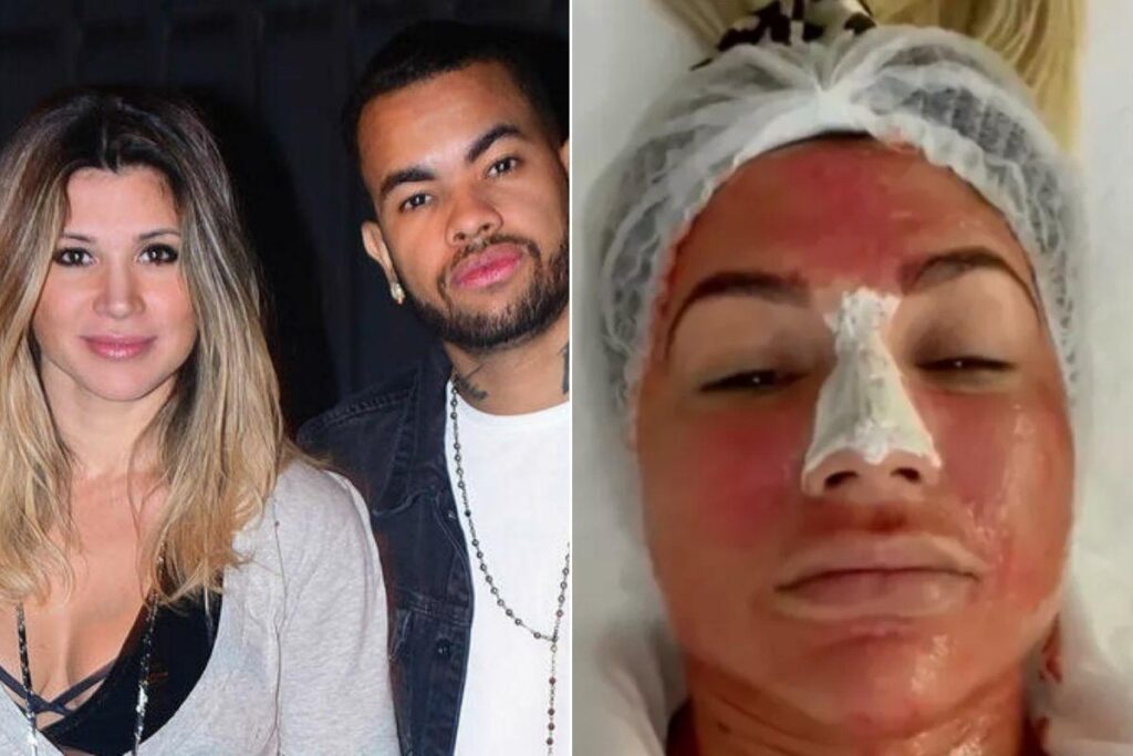 Dani Souza mostra tratamento facial feito com placenta