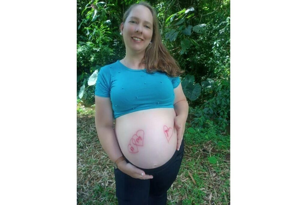 Um dia após dar à luz trigêmeos a mãe foi intubada