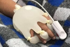 A técnica da ‘mãozinha’ viralizou nas redes sociais