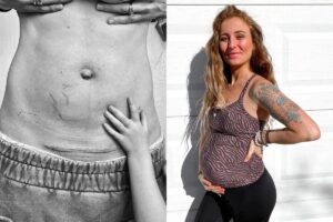 Mãe faz desabafo sobre parto cesárea e apoia outras mulheres