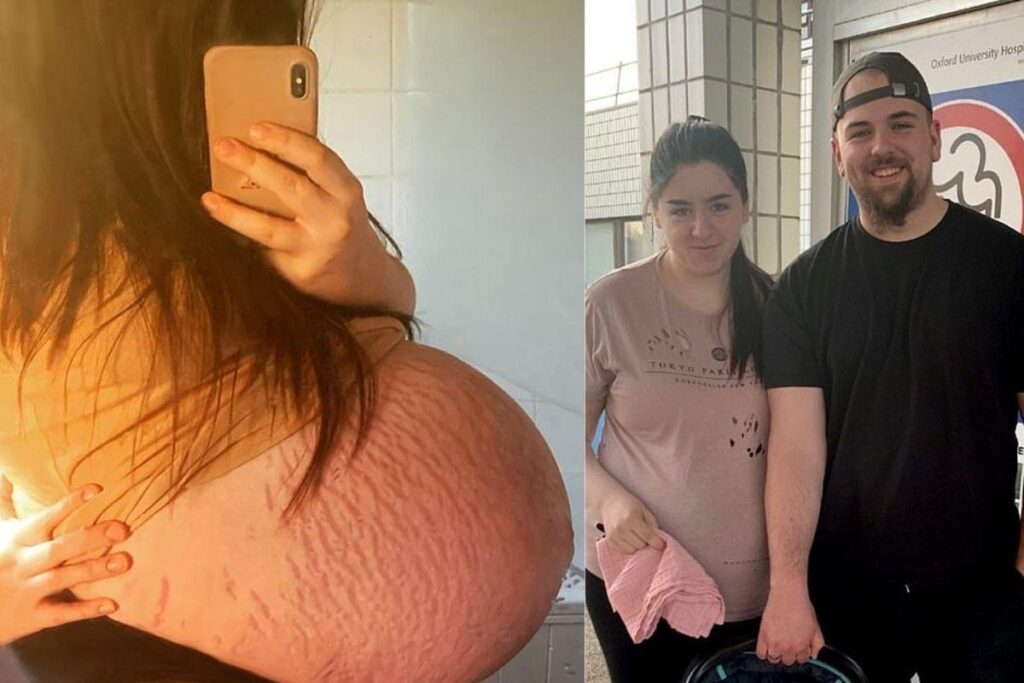 Britânica dá à luz segundo bebê mais pesado do Reino Unido