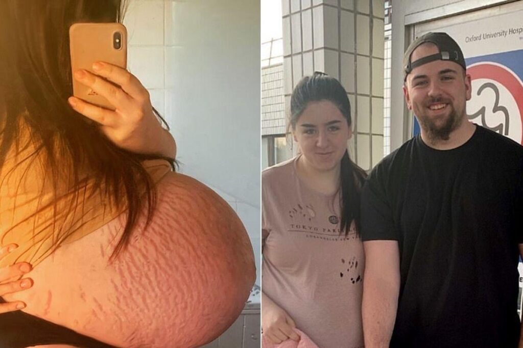 Mãe dá à luz bebê de quase 6kg