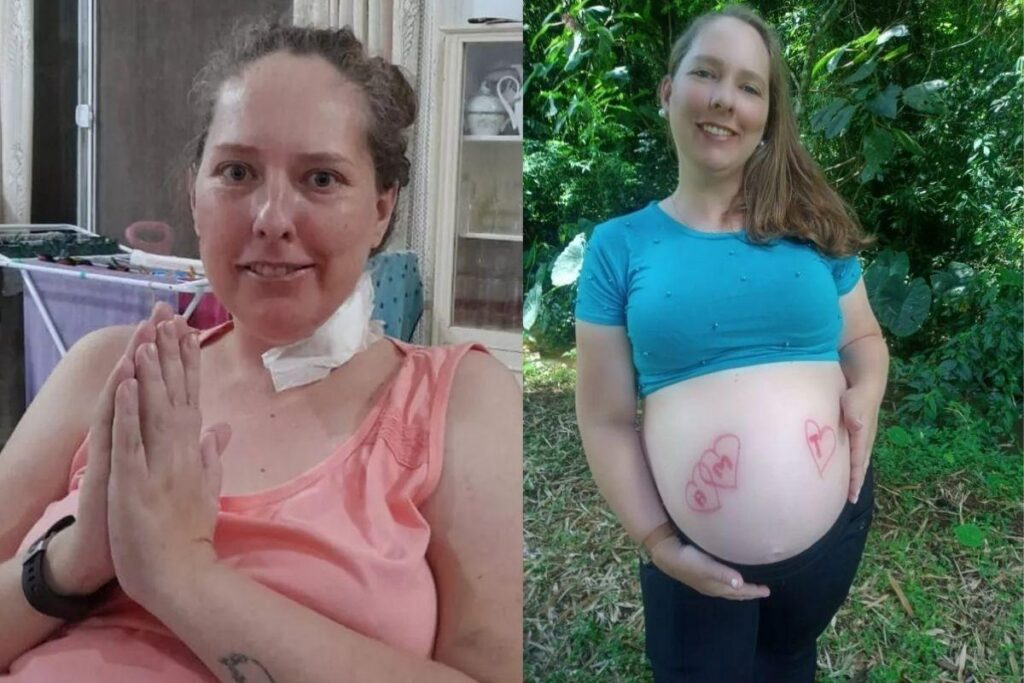 Caroline já recebeu alta e conta que já está tudo pronto para a chegada dos trigêmeos