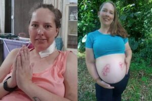 Caroline já recebeu alta e conta que já está tudo pronto para a chegada dos trigêmeos