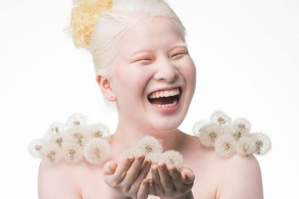 Bebê abandonada se torna modelo internacional