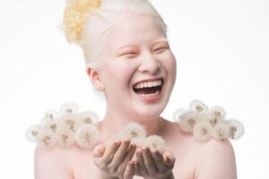 Bebê abandonada se torna modelo internacional