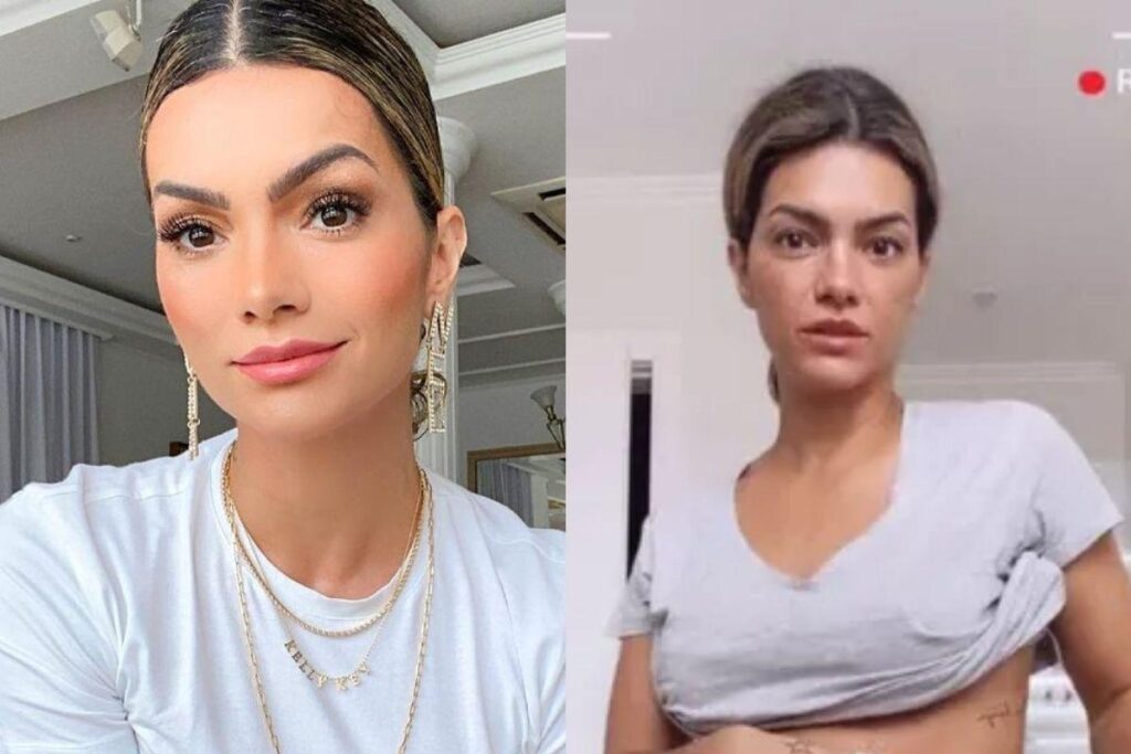 Kelly Key mostrou os curativos após realizar a cirurgia na sexta-feira, 30 de abril