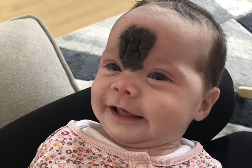Vienna nasceu com marca de nascença entre os olhos e os pais estavam determinados em removê-la