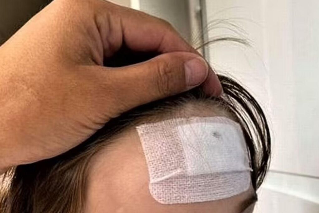 Pavão ataca menino de 3 anos em zoológico no Reino Unido e mãe faz alerta: “Poderia ter ficado cego”