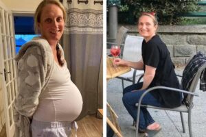 Ela acabou perdendo doze quilos durante a gravidez devido à condição