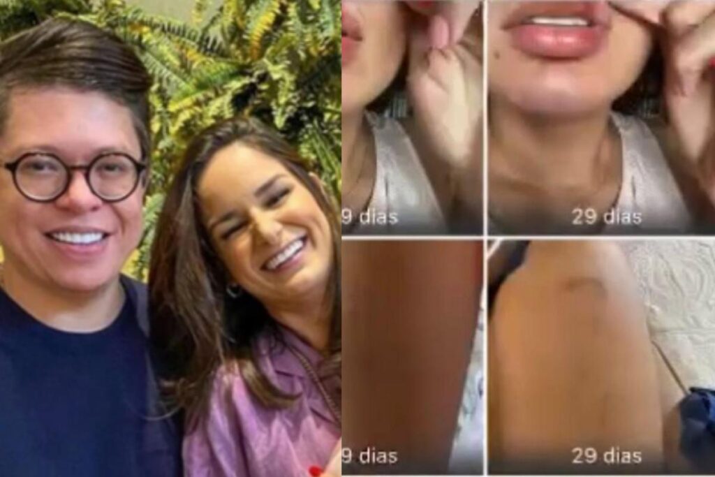Pamella expôs fotos dos machucados e prints de conversas com o ex-marido