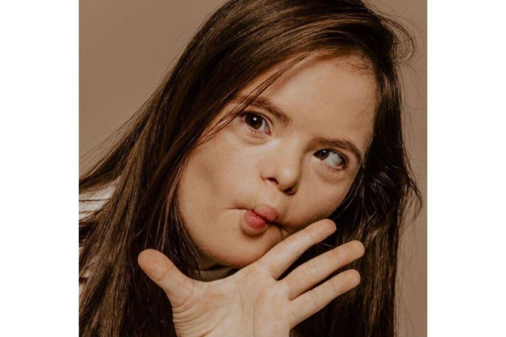 Resultados de busca no Google sobre Síndrome de Down