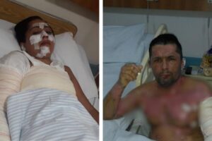 Partes da casa e bens materiais foram atingidos pelas chamas