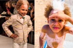 Samuel com a família, que também possui a condição