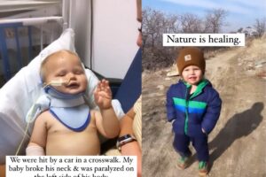 Watson teve que reaprender a engatinhar e andar