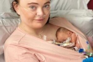 Darcey nasceu com 800 gramas e apenas 26 semanas