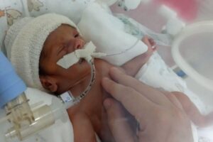 Theo precisou ficar internado por 27 dias