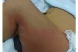 O menino foi levado para a UTI