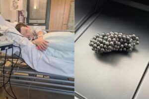 Jack teve parte do intestino removida por causa da brincadeira