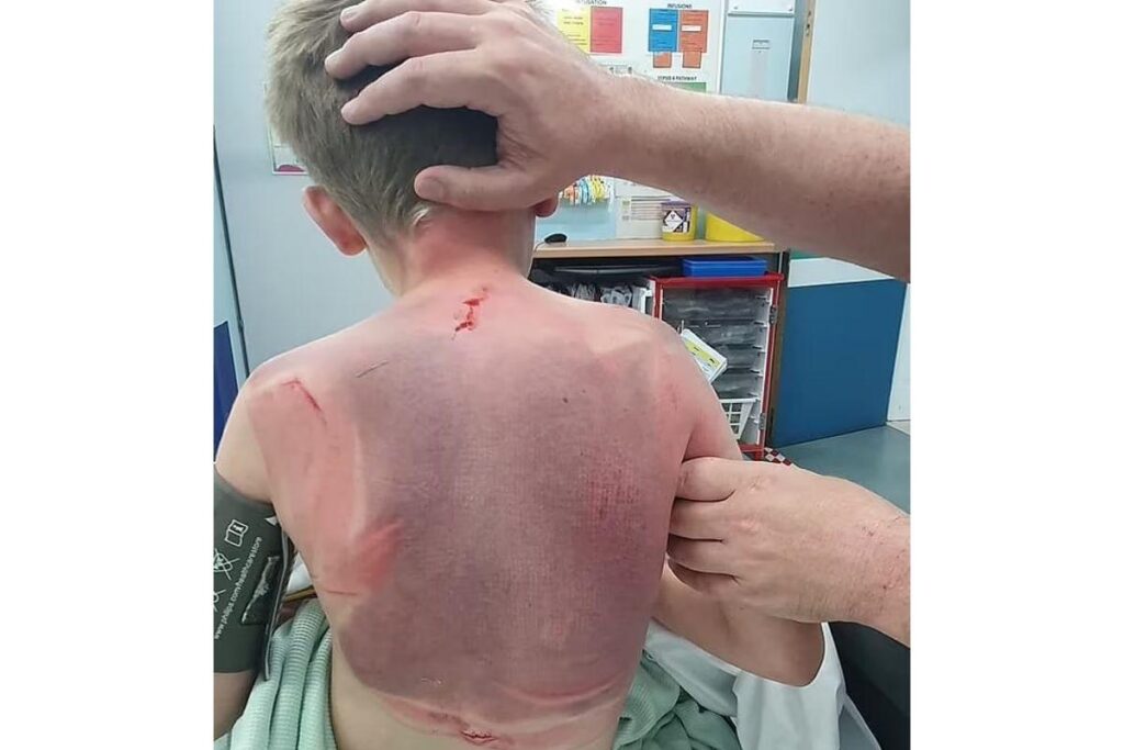 O menino ficou inconsciente