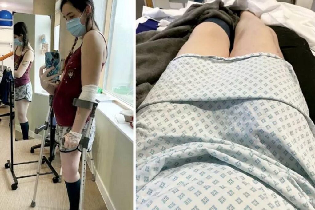 Grávida amputa perna para salvar bebê