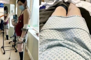 Grávida amputa perna para salvar bebê