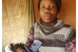 A menina nasceu com uma rara condição