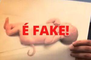 Imagem de bebês com rabo, pelos e membros a mais não tem relação com vacina da covid-19