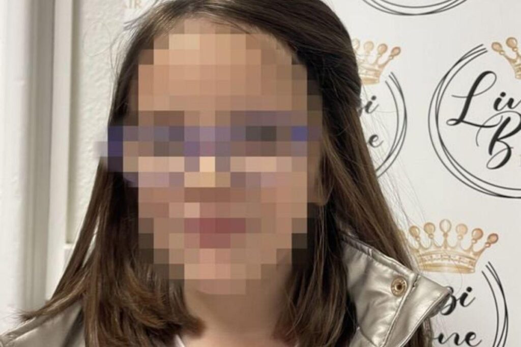 A menina perdeu boa parte do cabelo no acidente