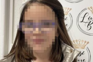 A menina perdeu boa parte do cabelo no acidente