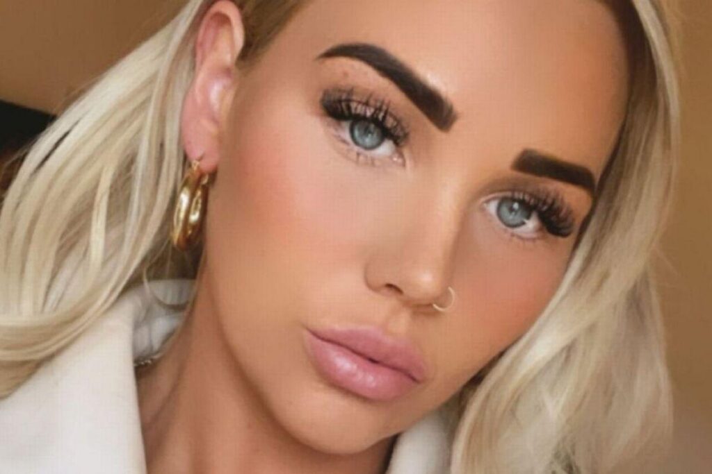 A verruga era pequena porém maligna