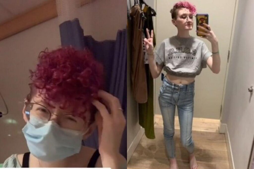 Chess descobriu a gravidez no momento do parto e achou que as contrações eram dores causadas pela síndrome do intestino irritável