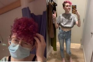 Chess descobriu a gravidez no momento do parto e achou que as contrações eram dores causadas pela síndrome do intestino irritável