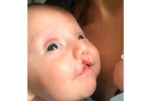 Isabel Hickmann mostrou o antes e o depois do filho