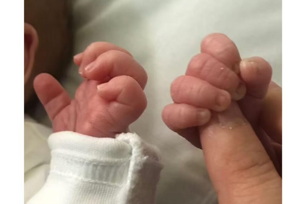 Irmãos gêmeos, Chester e Otis