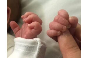 Irmãos gêmeos, Chester e Otis