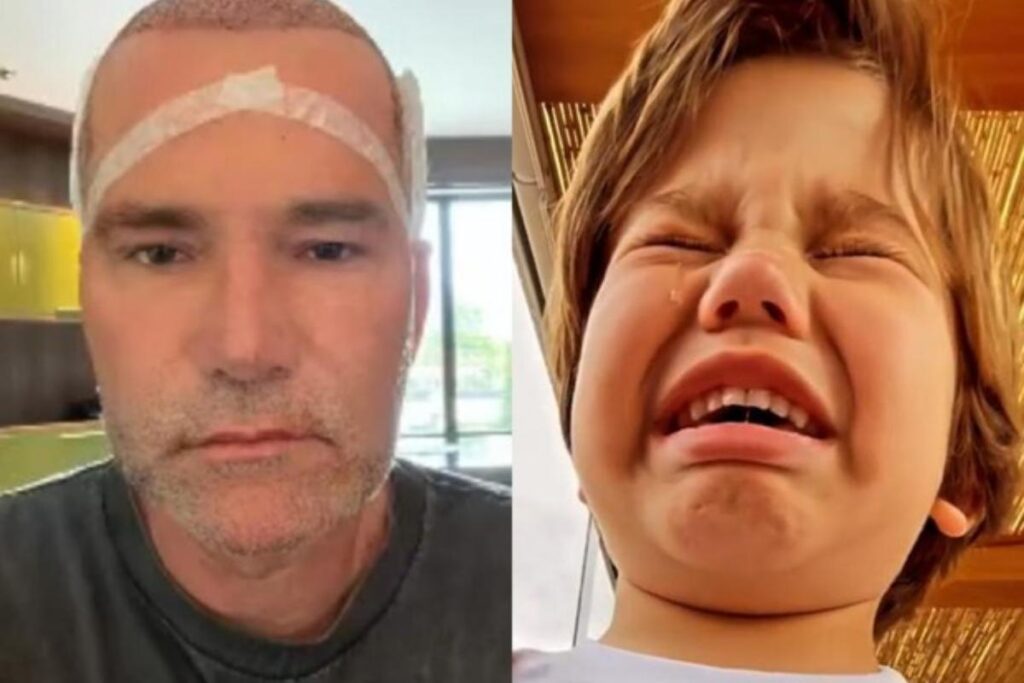 José caiu nas lágrimas ao descobrir o transplante capilar do avô